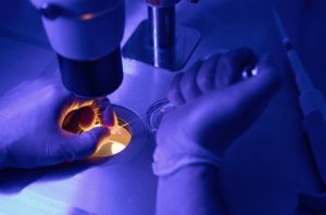 Read more about the article Jak test biopsji oddechowej może zmienić fakt wczesnego wykrywania raka